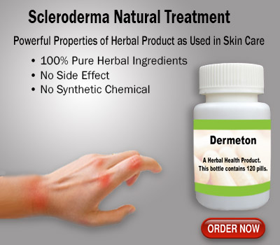 Natural Treatment for SclerodermaHealth and BeautyHealth Care ProductsNoidaNoida Sector 14