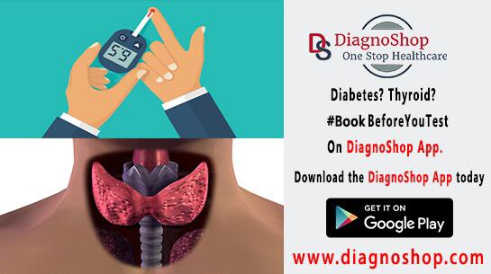 best diagnostic centre in hyderabad | list of diagnostic centres in hyderabad