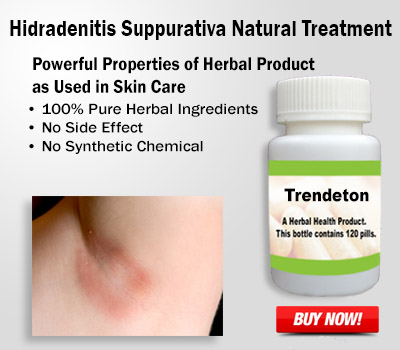 Natural Treatment for Hidradenitis SuppurativaHealth and BeautyHealth Care ProductsNoidaNoida Sector 10