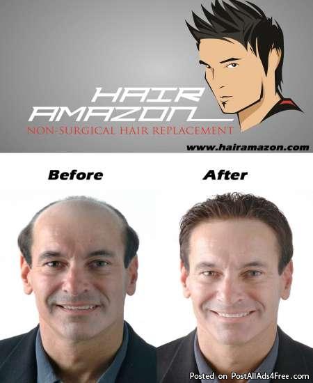 Hair Weaving / Hair Bonding / Non-Surgical Hair ReplacementServicesHealth - FitnessAll Indiaother