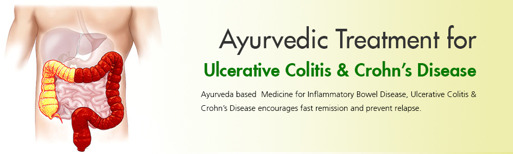Online Ulcerative Colitis Treatment in Ayurveda