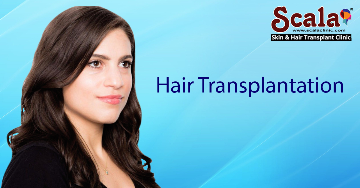 Best Hair Transplantation Clinic in Hyderabad| Top Hair Transplant Surgeons in Hyderabad