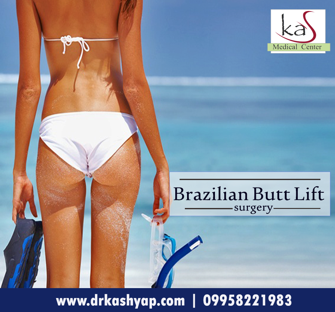 Brazilian Butt Lift Surgery IndiaHealth and BeautyClinicsSouth DelhiVasant Vihar