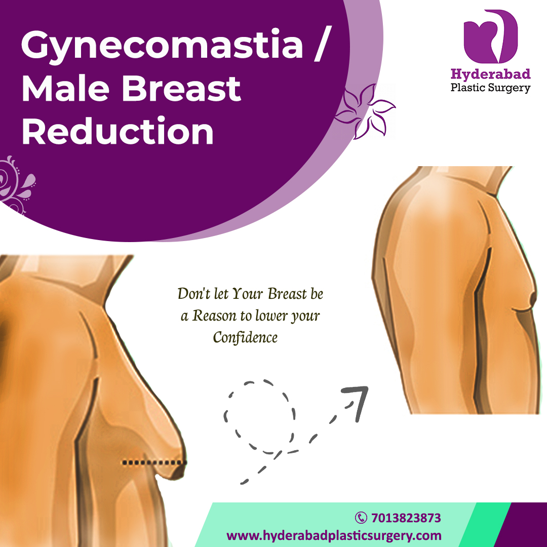 Best Gynecomastia Surgery in HyderabadServicesHealth - FitnessAll Indiaother