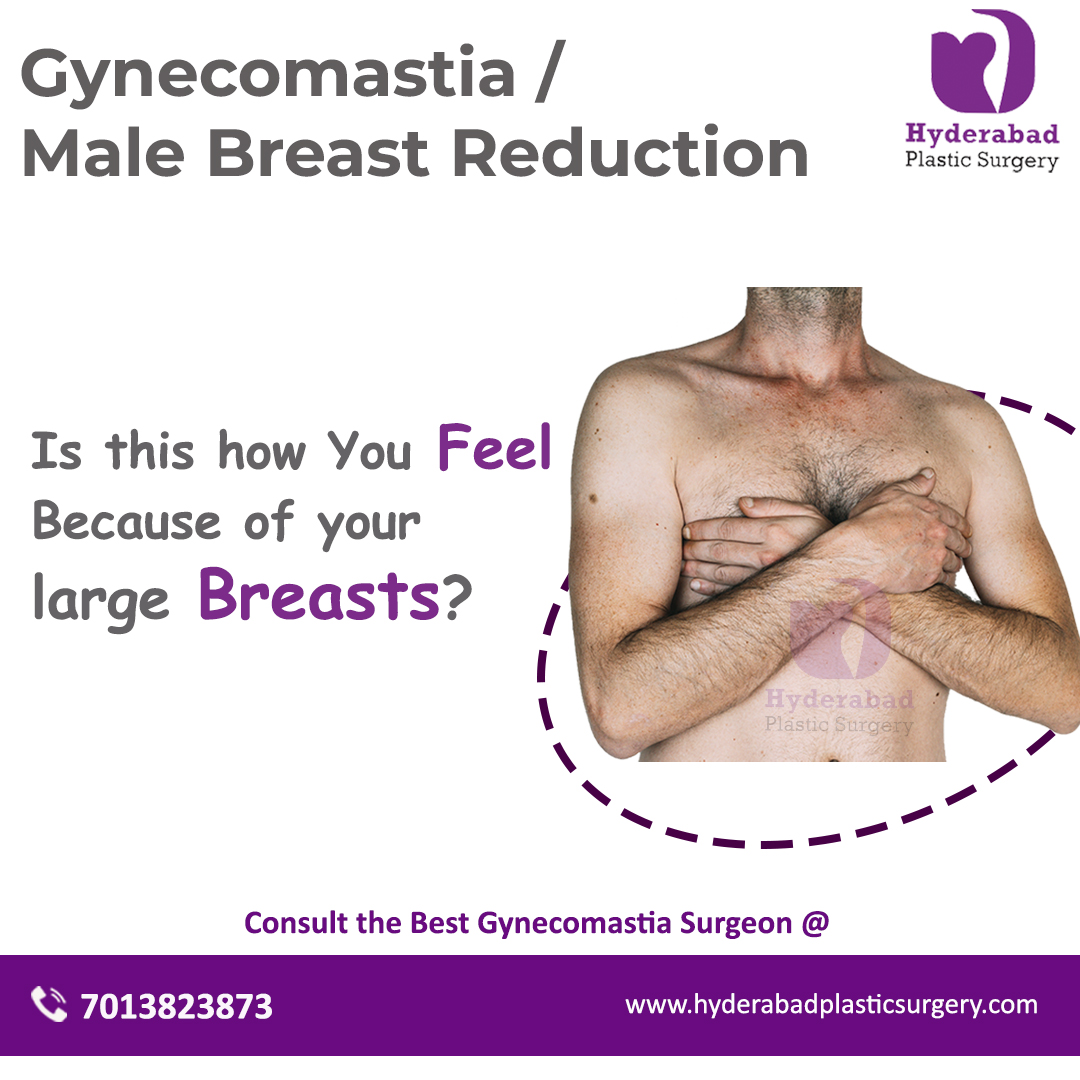 Gynecomastia Enlarged breasts in menOtherAnnouncementsAll Indiaother