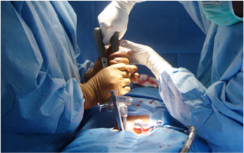 Top Surgical Treatments to Help You Heal from Trauma