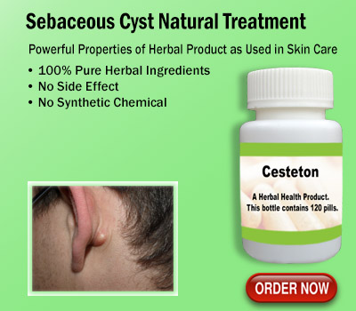 Sebaceous Cyst Natural TreatmentHealth and BeautyHealth Care ProductsNoidaNoida Sector 12