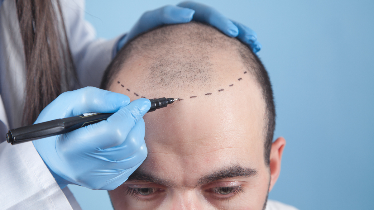 Dr. Ajinkya Patil- Hair Transplant Surgeon in PuneServicesHealth - FitnessAll Indiaother
