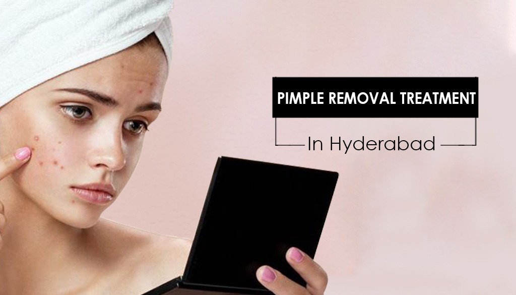 Pimple removal treatment.Health and BeautyClinicsAll Indiaother