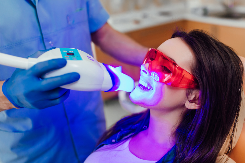 Laser Whitening in Mumbai