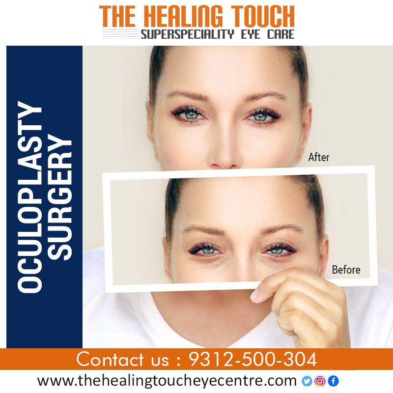 Oculoplasty Treatment in DelhiHealth and BeautyHospitalsWest DelhiVikas Puri