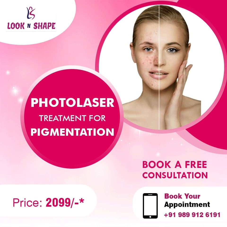 Need Skin Pigmentation Treatment In Delhi| Look N ShapeHealth and BeautyHealth Care ProductsCentral DelhiConnaught Place